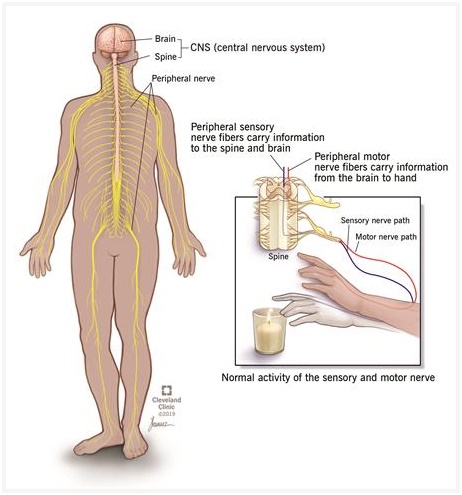 Neuropathy